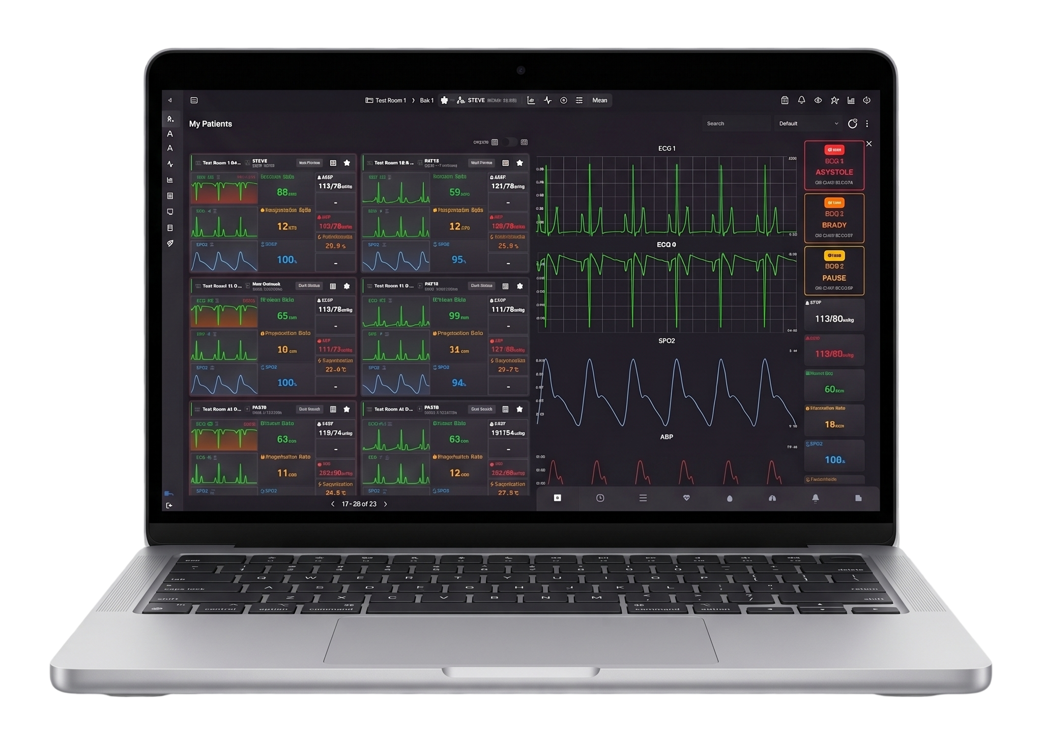 BIOX Smart Hospital Dashboard displaying real-time vitals